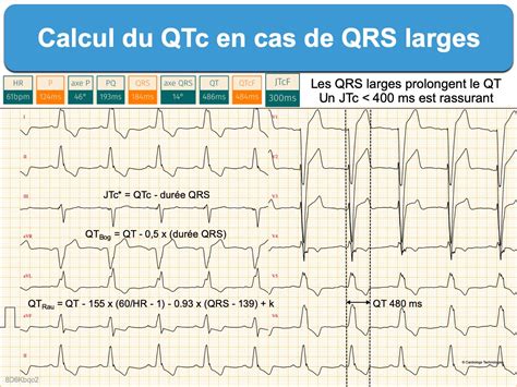 Sinais E Slots De C++ Qt